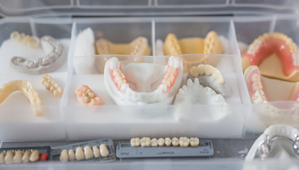 Unlocking Precision and Perfection with Custom Dental Prosthesis from Paulding Dental Prosthetics